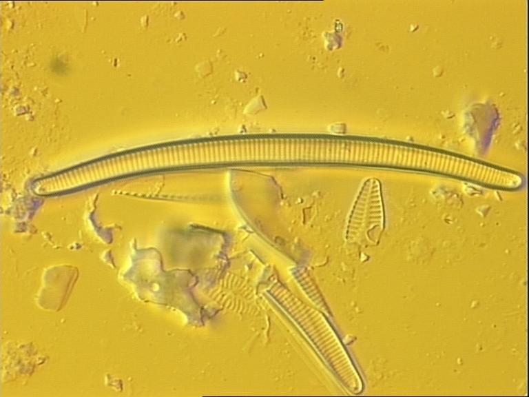 Eunotia mucophila, (Lange-Bertalot & Nörpel Schempp) Lange-Bertalot, 2005 | Sandre 